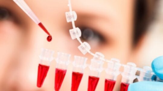 Covid-19: un’analisi del sangue rivela quanto è grave l’infezione
